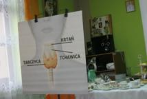 O chorobach tarczycy w Civitas Christiana